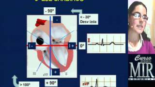 Cómo interpretar un ECG repaso [upl. by Aerbma976]