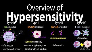 Hypersensitivity Overview of the 4 Types Animation [upl. by Hakon]