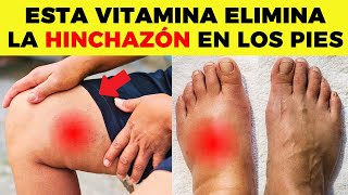 ESTA es LA MEJOR VITAMINA para ELIMINAR la HINCHAZÓN en PIES y PIERNAS [upl. by Zere]