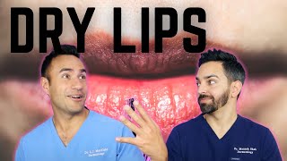 DRY CHAPPED LIPS DERMATOLOGY TIPS [upl. by Anyrtak]