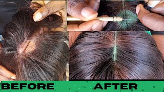 FIX IT LIKE A PRO How to repair ripped lace closure laceclosure [upl. by Dickenson706]