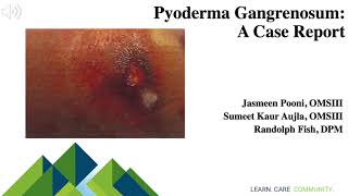 Pyoderma Gangrenosum A Case Report [upl. by Akinad]