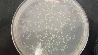 CFU Colony Forming Unit amp cfuml calculation [upl. by Kirshbaum114]