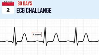 Day 2  The P Wave on EKG  Join the 30Day ECG Challenge Now [upl. by Myke]