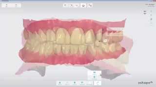 3Shape TRIOS  Analyze Page Tools [upl. by Potts10]