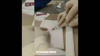 Aula Prática  Hematologia Clínica 🩸shorts study farmacia [upl. by Nileuqay]