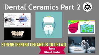 Dental Ceramics  Part 2 [upl. by Eillit]