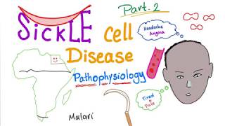 Sickle Cell Disease “part 2”  Pathophysiology [upl. by Aerdnaed]