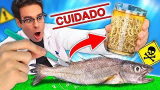 Encontré GUSANOS ANISAKIS en el PESCADO y No Creerás Lo Que Pasó [upl. by Jacki]