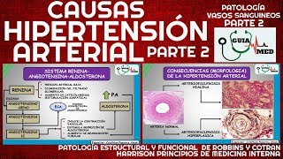 SINTOMAS DE HIPERTENSIÓN ARTERIAL FISIOPATOLOGÍA PARTE 2  GuiaMed [upl. by Adiela738]