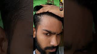 ADIVASI HAIR OIL REVIEW DAY 30 😱 adivasihairoil adivasihairoilreview shorts ytshorts minivlog [upl. by Ziana]