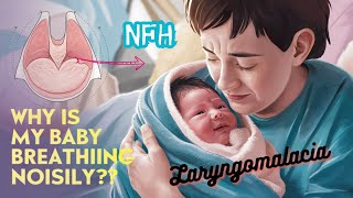 Noisy breathing in babies  Laryngomalacia  Stridor in babies  Baby breathing problems [upl. by Notgnirrac]