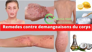 COMMENT CALMER LES DÉMANGEAISONS DU CORPS  Rama Health amp Beauty [upl. by Khan]