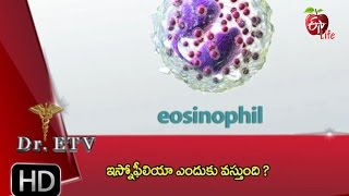 Dr ETV  Eosinophilia allergy  24th January 2017  డాక్టర్ ఈటివీ [upl. by Roselia]