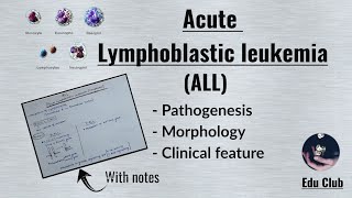 ALL Acute Lymphoblastic LeukemiaLymphoma  Disorders of White Cells  Lymphoid neoplasm Pathology [upl. by Nirhtak]