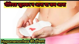 पीरियड खुलकर न आना या कम आना  Light periods पीरियड्स के दौरान कम ब्लीडिंग  Hypomenorrhea [upl. by Cynar]