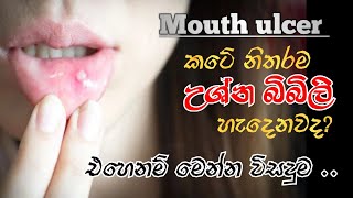 මුකයේ ඇතිවෙන උශ්න බිබිලි සදහා විසදුමHow to treat mouth ulcer [upl. by Armillia331]