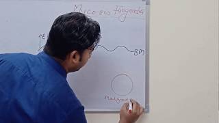 Mycosis Fungoides and Sezary Syndrome [upl. by Enylrac]