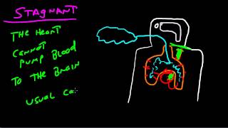 The Four Types Of Hypoxia [upl. by Notgnimer]