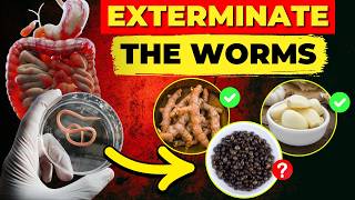 12 Foods That Destroy Intestinal Parasites EXTERMINATE The Worms [upl. by Fawn266]