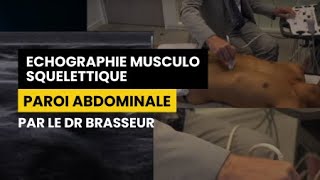 PAROI ABDOMINALE  Echographie Musculo squelettique par le Dr Brasseur [upl. by Ybbob]