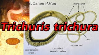 Trichuris trichiura [upl. by Heiskell992]