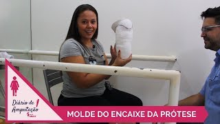 DIÃRIODEAMPUTAÃ‡ÃƒO EP07 COMO FAZ O MOLDE DA PRÃ“TESE  BLOG ANA K [upl. by Noryak783]