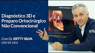 Diagnóstico 3D e Preparo ortodôntico para cirurgia ortognática com Dr Ertty Silva [upl. by Adna]