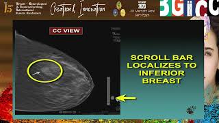 Tomosynthesis an approach to interpretation Prof Michael Linver [upl. by Labana]