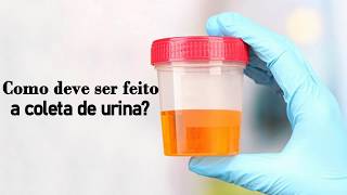 COMO DEVE SER FEITA A COLETA DA URINA UROCULTURA [upl. by Aizirk862]