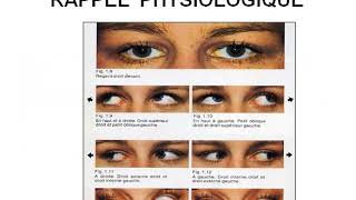 Troubles de la motilité oculaire Diplopie Strabisme [upl. by Braun881]