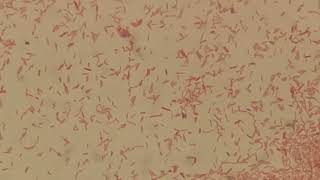 Moraganella morganii in Gram Staining [upl. by Tierell807]