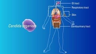 Sources of Candida Organisms [upl. by Notrab760]