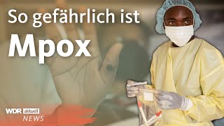 Mpox WHO ruft weltweite Notlage aus  WDR Aktuelle Stunde [upl. by Aileek]