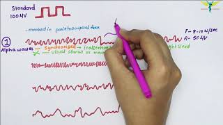 Electroencephalogram EEG  Waves  Physiology [upl. by Euqitsym611]