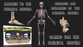 Skeletal SystemInjuries Diseases Disorders  Caring of the Skeletal System Teacher Beth Class TV [upl. by Broida]