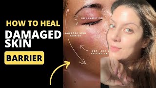 How To Heal Damaged Skin Barrier  How to treat broken skin barrier  Nipun Kapur [upl. by Bronwyn272]