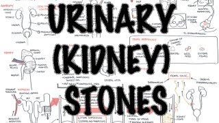 UrinaryKidney Stones  Overview signs and symptoms risk factors pathophysiology treatment [upl. by Ycaj]