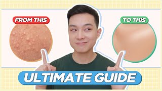 ULTIMATE GUIDE to Treat amp Prevent BLACKHEADS WHITEHEADS TINY BUMPS for FILIPINO SKIN  Jan Angelo [upl. by Nabi]