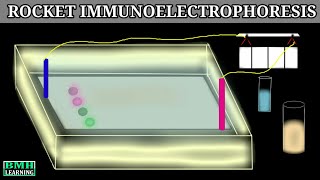 Rocket Immunoelectrophoresis  Immunoelectrophoresis [upl. by Tavy469]