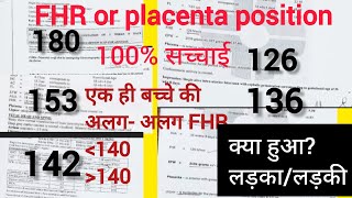 FHR or placenta position की 100 सच्चाई140 से ऊपर और नीचे क्या हुआ है लड़का लड़कीMomsactivelife [upl. by Oech]