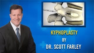 What is involved with a Kyphoplasty procedure [upl. by Yeroc]