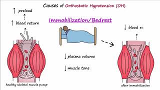 Orthostatic Hypotension Described Concisely [upl. by Zakarias185]