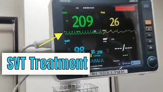 Adenosine in Supraventricular tachycardia SVT How to administer and how it works [upl. by Nottage929]