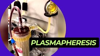 What is Plasmapheresis  How Plasmapheresis works [upl. by Rothenberg65]