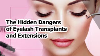 The Hidden Dangers of Eyelash Transplants and Extensions [upl. by Ykcim]