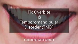 Fix Overbite  Temporomandibular Joint Disorders TMD  TMJ [upl. by Soiritos441]