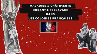 MALADIES ET CHÂTIMENTS DURANT LESCLAVAGE YEKRIK [upl. by Cutlor]