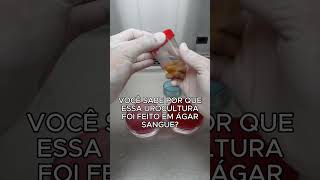 Como uma urocultura é feita no laboratório shorts microbiologia [upl. by Larual]