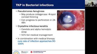 Penetrating Keratoplasty in Infectious Keratitis [upl. by Gilson]